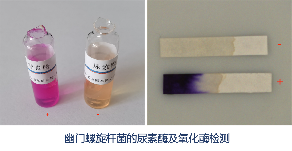 幽门螺杆菌尿素酶与氧化酶检测