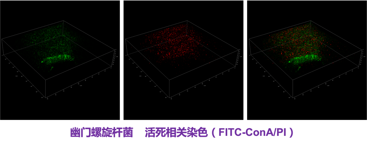 幽门螺杆菌三维活死染色